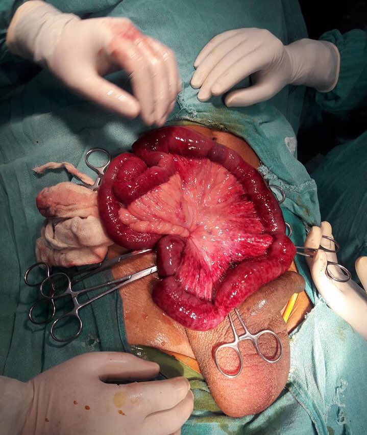 DrAjaySingh29's tweet photo. THEN :- NEKI KAR, DARIYA MAIN DAAL
NOW :- #MEDICAL_CASE KAR, #STORY PE DAAL
#MBBS_MEDICAL_LIFE 😪 https://t.co/OBkjc2BdtQ