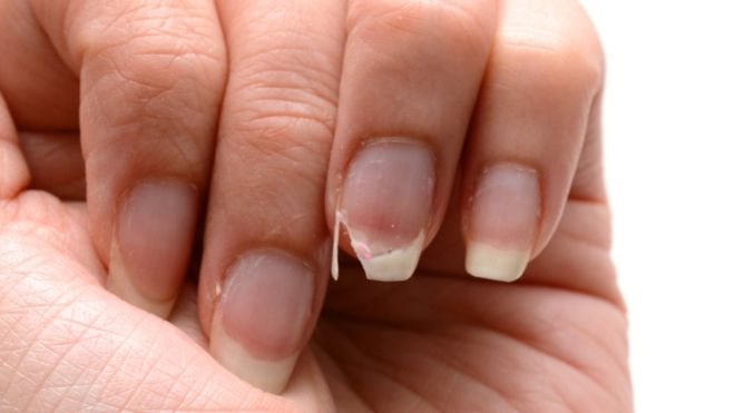 PSPolish's tweet photo. Random chipped or ripped nails always put a damper on my day, seriously! #Unamused  Dream by PS #ruinedmanicure #iwantstrongnails #healthynails
.
.
.
#naillacquer #antifungal #instanailart #nailhardener #veganpolish #pspolish #nailart #misshaps #nontoxic #instastyle https://t.co/IKwsh0EmMm