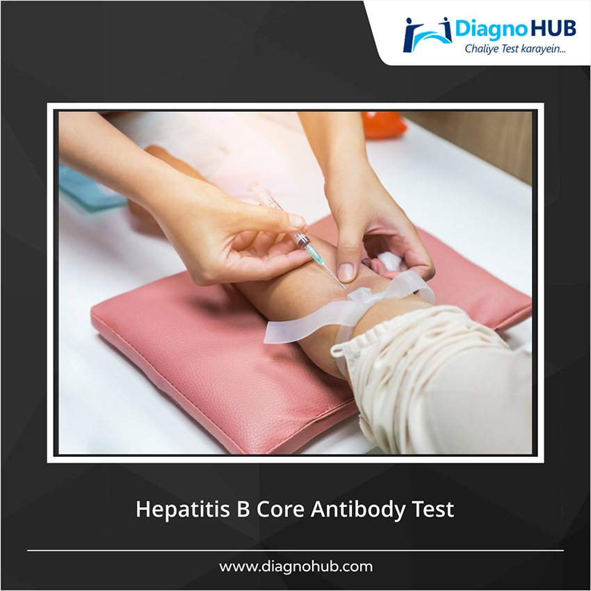 DiagnoHub's tweet photo. This test looks for antibodies called IgM in your blood. The test is used to find out whether you are actively infected with the hepatitis B virus (HBV)
#tests #medical #health #healthylife https://t.co/qYoETfvNum