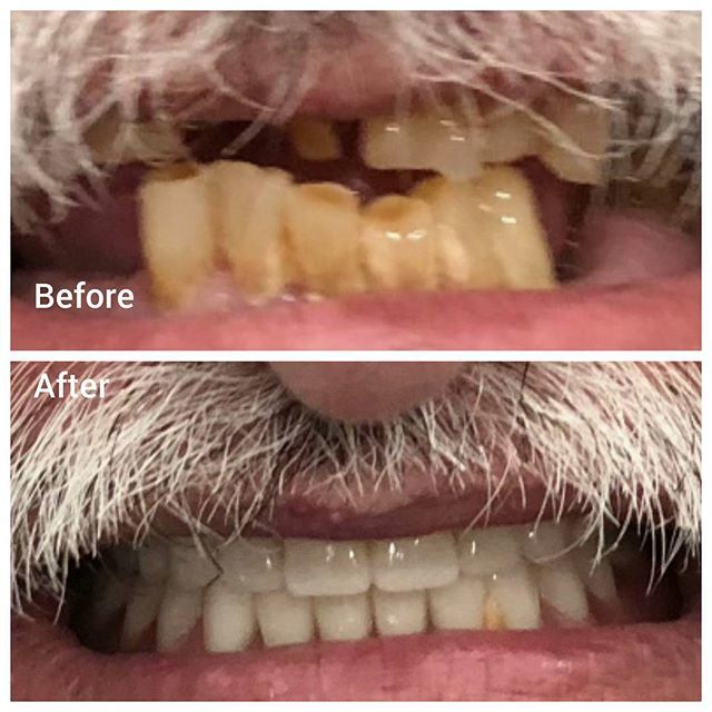 dearfielddental's tweet photo. Smiles all around!
.
.
.
.
#dearfield #family #dentistry #dentists #dentist #teeth #smiles #smiling #smile #pearlywhites #pearlywhite #hygiene #sofreshandsoclean #drgogate #rishidds #drlin #racheldds #teamworkmakesthedreamwork #healthcare #feature https://t.co/mbuybLzSTP https://t.co/V7BKluyUTS