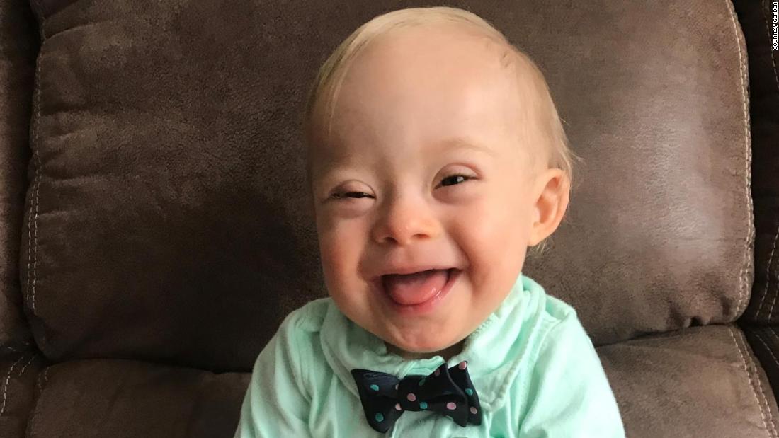 CNN's tweet photo. For the first time ever, the Gerber spokesbaby is a child with Down syndrome https://t.co/95G6iiwZLN https://t.co/ZiQxBKTgBy