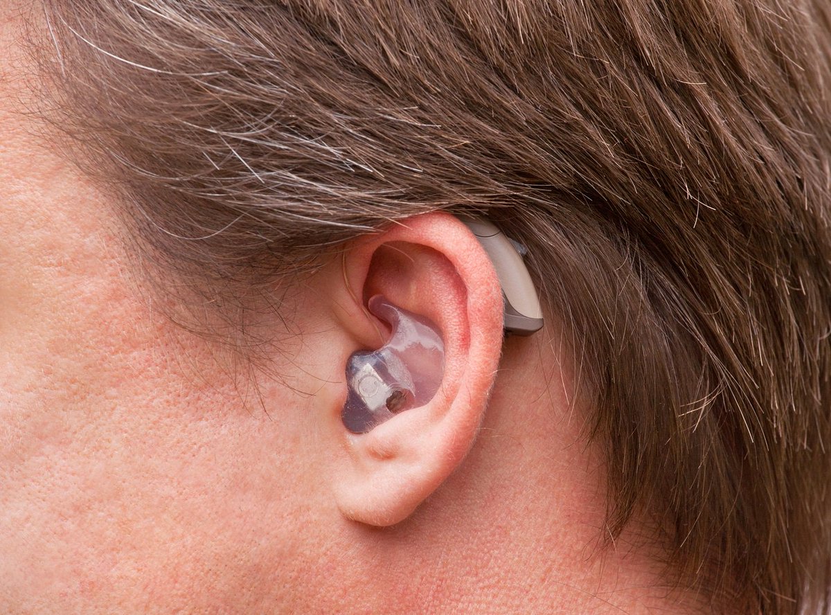 deleononline's tweet photo. Advances In Modern Digital Hearing Aid Technology https://t.co/gettF4krmm #Deleon #Electronics https://t.co/wIJk6iIp7j