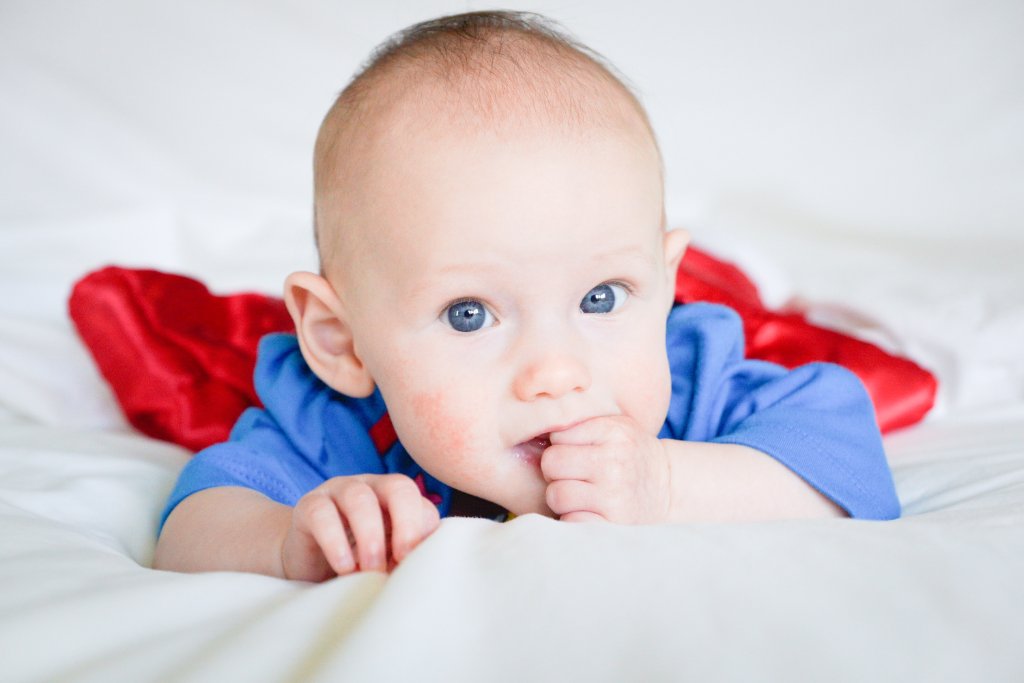 nmdp_org's tweet photo. Henley’s only hope of survival is a marrow transplant. Become one of 100 heroes this month to join us in the fight to find a cure for Henley. Give today: https://t.co/xja779JGjP https://t.co/aFXDjGWz3F