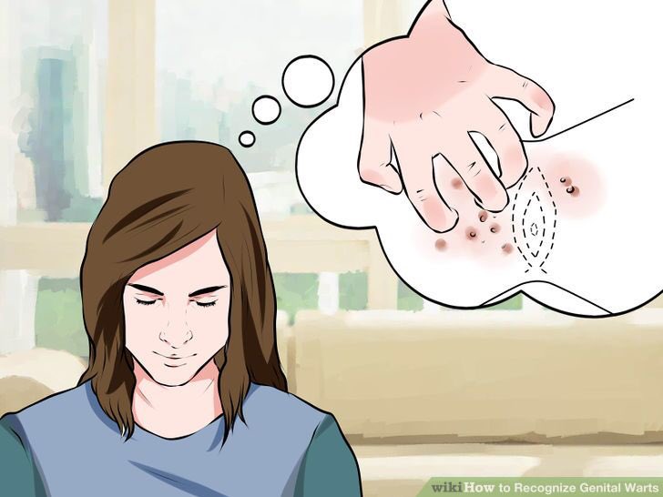 falluserectus's tweet image. Vrouwmens met jeuk..., soa