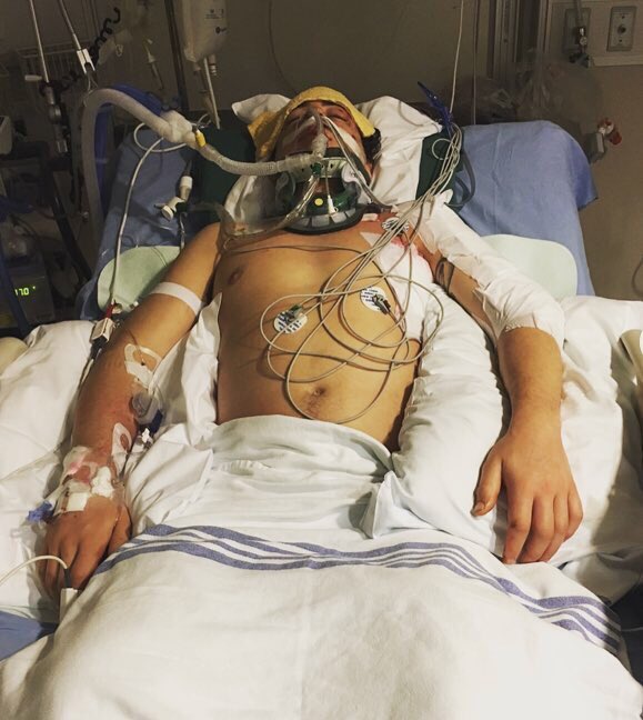 I speak all the time about finding hope.  This was Mark McMorris less than a year ago.  Machines kept him alive. They literally breathed life into him. Today he wins an Olympic medal and he breathes life into anyone who is struggling to find hope. Stunning. 
#SickNotWeak