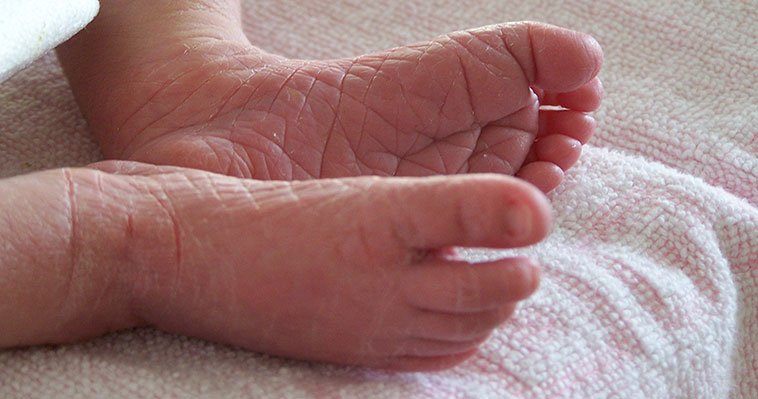 AbsSoftWater's tweet image. We answer your questions about 4 key #Natural elements that can cause serious #Skin problems&amp;gt;&amp;gt; #SkinCare #Health bit.ly/2DR5mXM