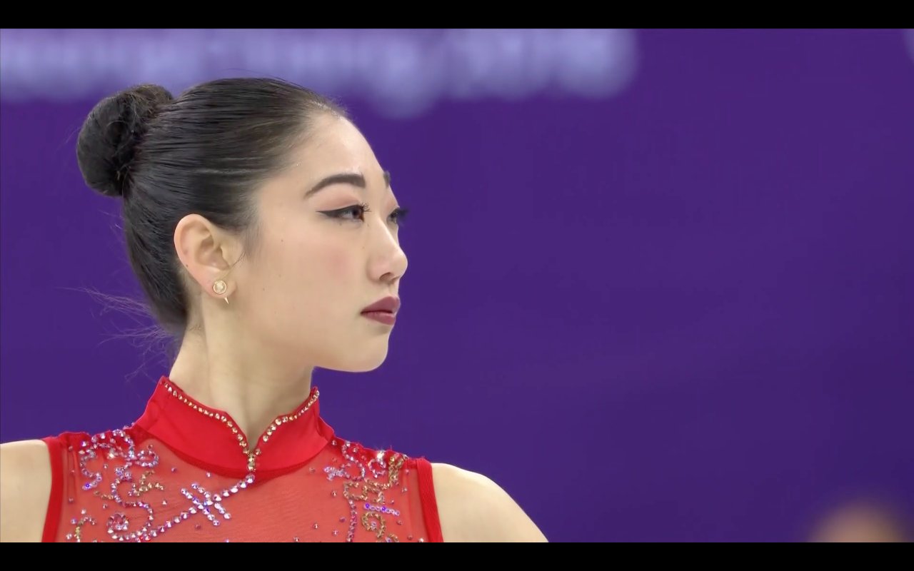 Mirai Nagasu, Atlet Putri Amerika Serikat Sempat Dikira Punya Tato Besar di Paha, Ini Penjelasannya!