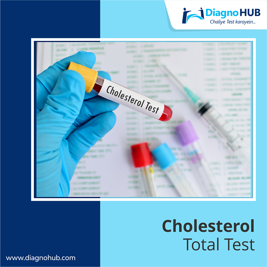 DiagnoHub's tweet photo. A complete cholesterol test measures the amount of “good” and “bad” cholesterol and triglycerides, a type of fat, in your blood.
#tests #medical #health #healthylife https://t.co/IH33IVIxjC