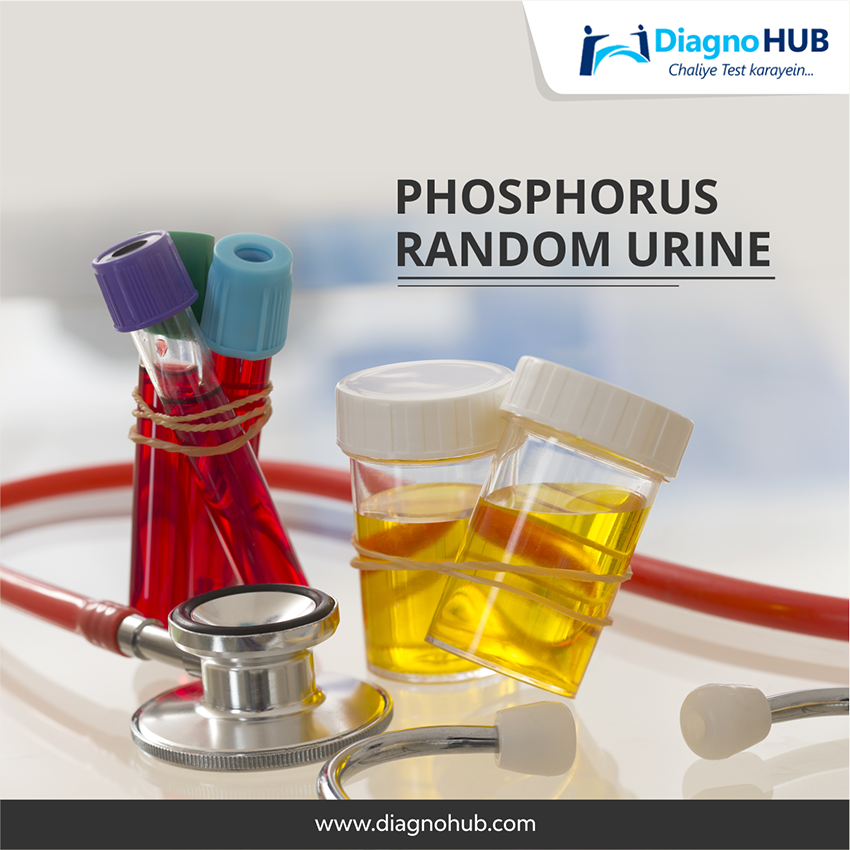 DiagnoHub's tweet photo. Phosphorus test is performed on a sample of random urine to measure the level of Phosphorus. It is performed to confirm Hyperphosphatemic Condition, Hypophosphatemic Condition, and Kidney Stones and also during treatment and after their treatment.
#medical #health #healthylife https://t.co/fbueJfmmjy