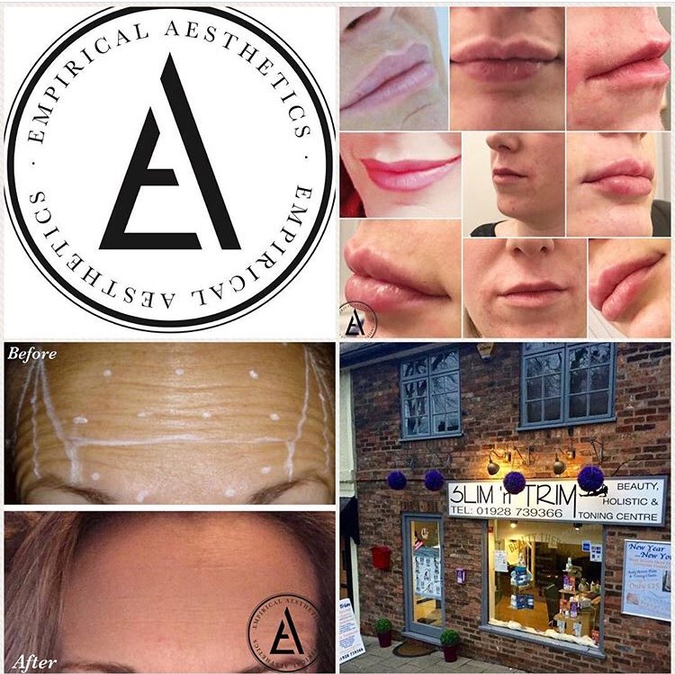 In Slim ‘n’ Trim, Frodsham, we now offer consultations and medical aesthetic treatments! Contact 01928 739366 for more info! 
#empiricalaesthetics #aesthetics