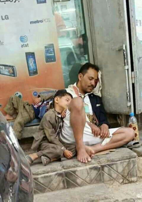 اسالكم بالله. حال هذا الانسان يرضيكم
 وين بتروحو من الله ياتجار الحروب وين بتروحو من الله يا السعوديه والامارات الي جالسين تطولو الحرب علشان مصالحكم الوسخه. شوفو شعب اليمن وين وصل. اتقو الله يامصاصين الدماء ياتجار الحروب يا دول التحالف يا عيال الكلب هذا حال اليمني