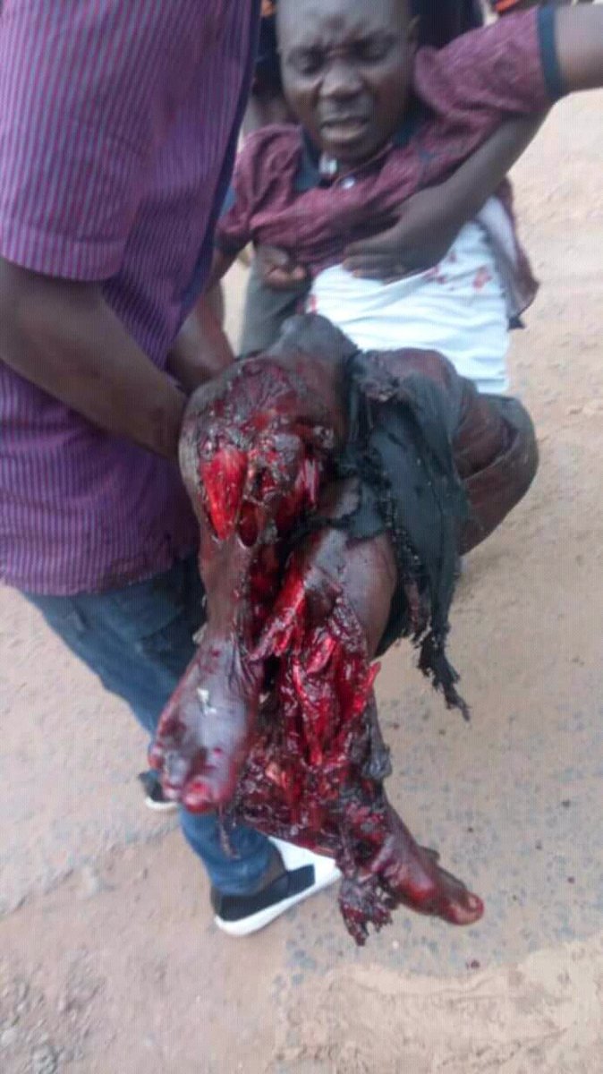MpozeTheo's tweet photo. @ndoligitare @jfmutesa @onduhungirehe @gmbonyumutwa @jamboasbl @Jambonewsnet Is not manipulation, is what U did as usual. Now U're killing #CongoleseRefugees in #KizibaCamp. & U've been doing this kind of CRUELTY since 1995.
#KibehoMassacres: + #8thousands of Refugees you killed.
#NkamiraCamp killings in Mudende.
#MappingReports: + #8millions u killed.👇 https://t.co/qQSLDeE29D