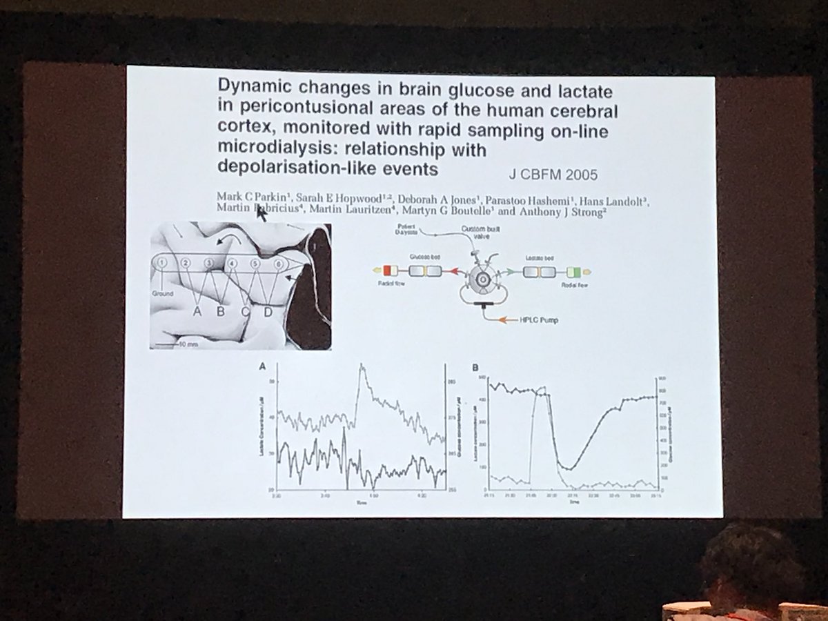 drdangayach's tweet image. @SCCM #CCC47 @NeuroLlama @zlhickman @JoshBedersonMD @MountSinaiNeuro Neuromonitoring: detection of cortical spreading depolarization