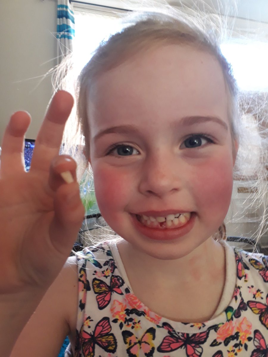 emmafogg3's tweet photo. @MrsCadamyQP finally Millie tooth is out. The tooth fairy will be visiting tonight. Xxx https://t.co/fnIfLG74hZ