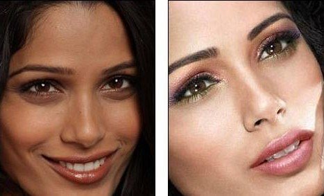 glutathione injection cost