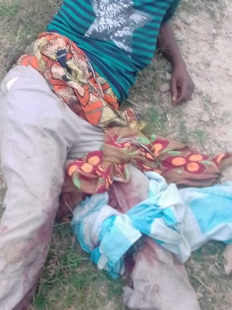 TheoMpoze's tweet photo. This proves that #Kagame has been killing REFUGEES since 1995. #Kibeho : + #8Thousands KILLED.
Nkamira #MudendeCamp: +1500 #CongoleseRefugees killed.
#DRC: #MappingReports 👉 + #8Millions of #CONGOLESES & #HutuRefugees killed.
#KizibaCamp: + 22 #CongoleseRefugees killed.
#RwOT https://t.co/frO7AMPtlq