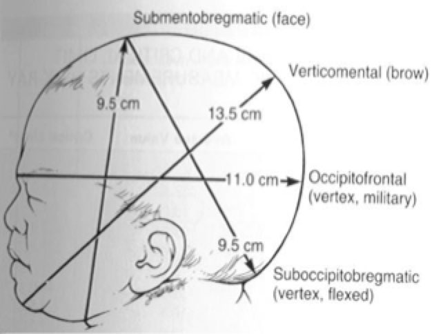 Image result for diameters of feta skull