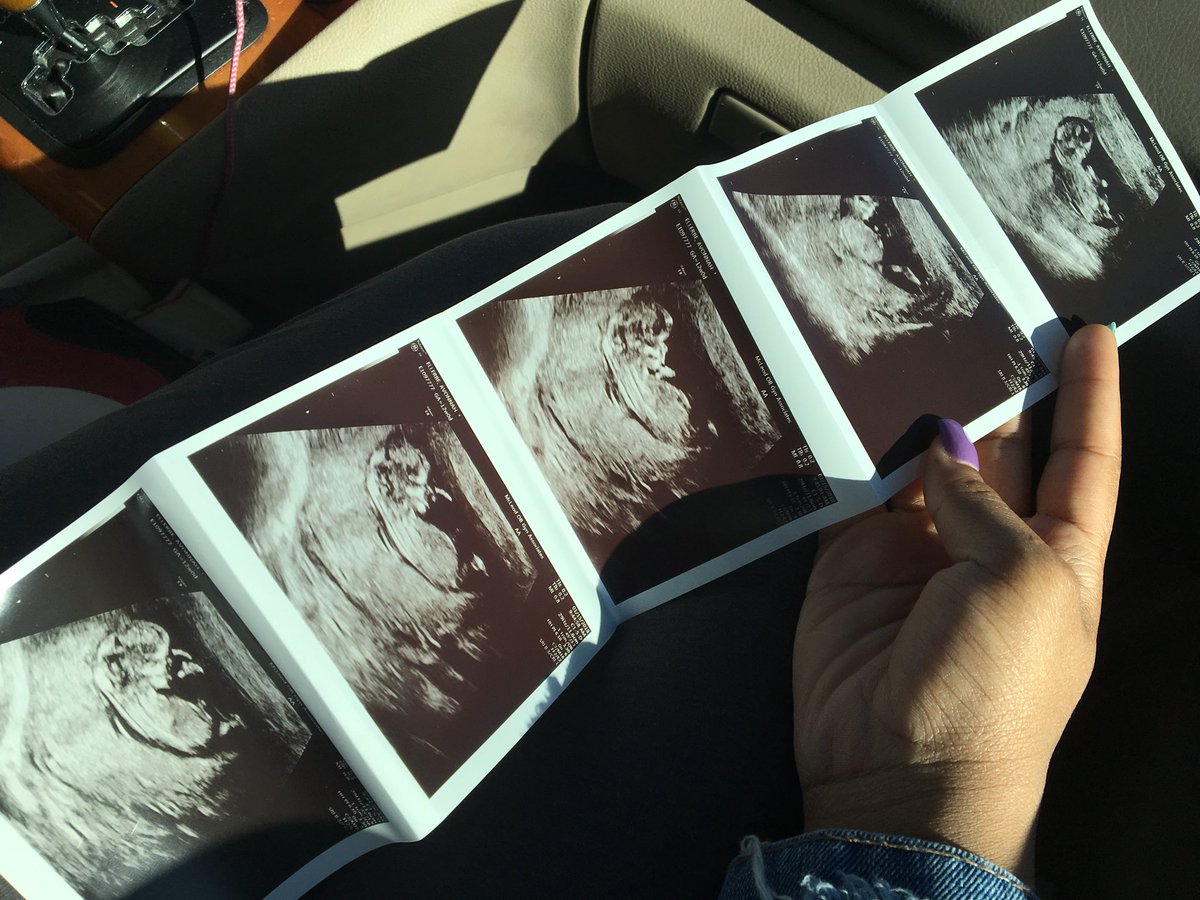 HouseOf_July's tweet photo. @RaequanB_ A whole baby bump https://t.co/b92q3uP8yj