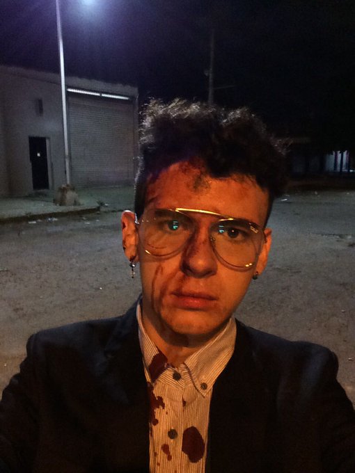 Me mataron grabando con @kazumiUCR 😂 https://t.co/JT865Oxsjj<a class="tags" target="_blank" title="On Twitter" href="/?out=eyJ0eXAiOiJKV1QiLCJhbGciOiJIUzUxMiJ9.eyJpYXQiOjE3MjU4NzExMzQsImlzcyI6InR3cG9ybnN0YXJzLmNvbSIsIm5iZiI6MTcyNTg3MTEzNCwiZXhwIjoxNzU3NDA3MTM0LCJyZWRpcmVjdF91cmwiOiJodHRwczovL3R3aXR0ZXIuY29tL2thenVtaVVDUiJ9.ooTQcK-ofN9gGLj7yn6JT6c0CYipc_inEsXFg-ApGe0dPAcdCwo-D6kL1RnrXqmpClU9776jHKqNhMpHEH4uaw">@kazumiUCR</a>