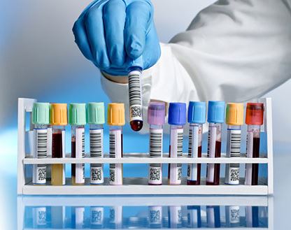 We'll be discussing how best to prioritise lab tests at our networking video call on March 7 at 12.45pm GMT.  Details available to members on meetup.com/Functional-Med… #FunctionalMedicine