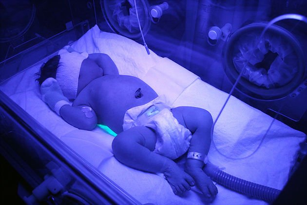 healthtechO2O's tweet photo. Blockchain Babies: Using Blockchain to Control a Novel Neonatal Device

https://t.co/NGKCkoiR4q #HealthTech #obesity #Asthma #allergies #ICO #token https://t.co/Qc9DDjWmyg