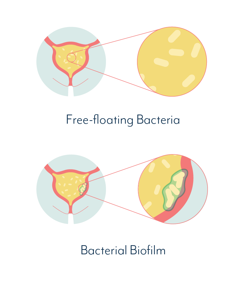 liveUTIfree's tweet photo. Let's talk biofilms: That's an escalated level of infection where a pathogen goes to a lot of trouble to build a resilient community that is in it for the long haul. #UTIscience #biofilms #chronicUTI https://t.co/VopE2lSAkV https://t.co/VRktRh5adk