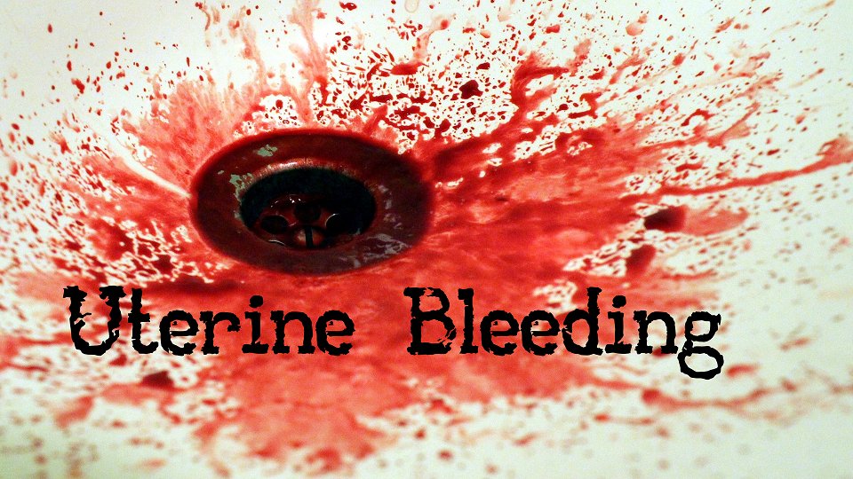 freeemergtalks's tweet photo. Happy Valentine's Day!

Bleeding heart today? 
Why not learn about massive uterine bleeding instead.

@EM_sandbox #FOAMed

https://t.co/eeJjU6IFyn https://t.co/XMqrE5dMoy