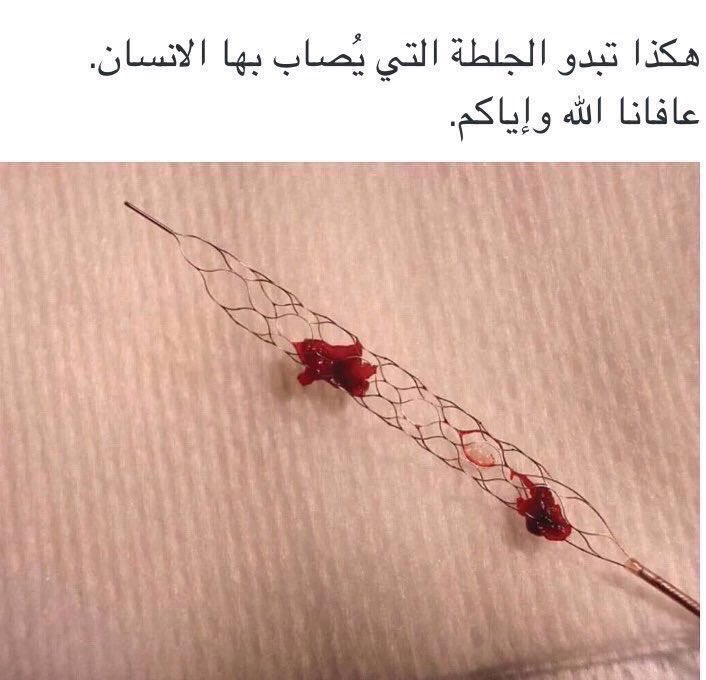 facts444's tweet photo. ﴿وَخُلِقَ الْإِنْسَانُ ضَعِيفاً﴾ https://t.co/CALR2MFyLY