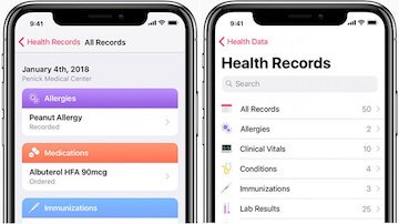 LetsFaceItCare's tweet image. "Why #AppleHealthRecords in #iPhones Could BE a Big Deal - and Why it Might Not Be"
letsfaceit.care
#LatestHealthCareNews