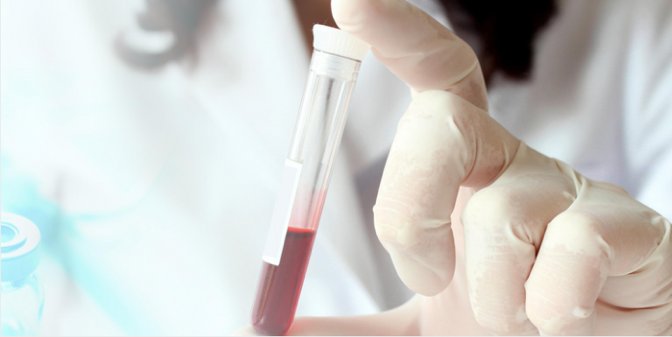 banyanbio's tweet photo. FDA Grants Marketing Authorization to Banyan Biomarkers for the First Diagnostic Blood Test for #TraumaticBrainInjury https://t.co/ABQJrgk02A
#TBI #Concussion https://t.co/9cOU9the5v