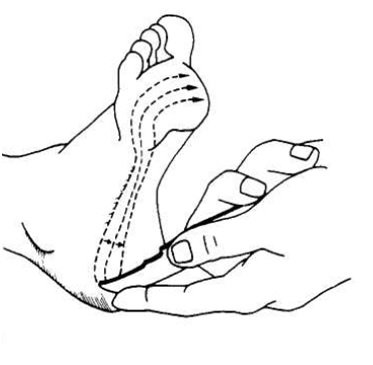 physiopedia's tweet photo. Did you know that alcohol intoxication could cause the Babinski sign? https://t.co/UPSdThA8Vs https://t.co/jqldYGeSqs