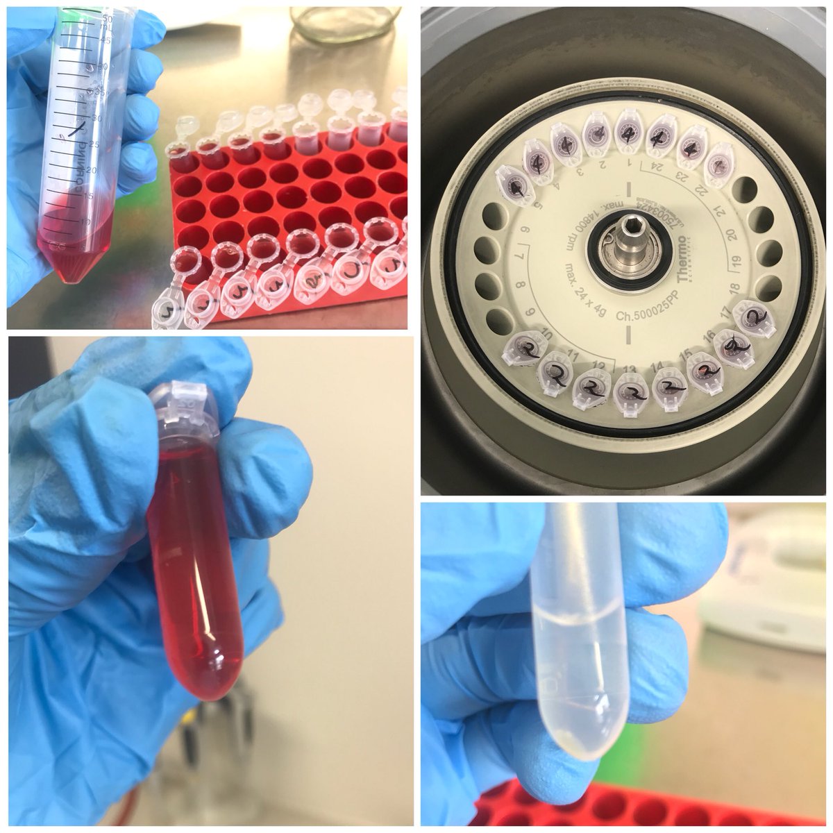 phili_mi's tweet photo. Preparing mycoplasma wild-type &amp; mutants for a #NET assay. M. bovis grows well Frey’s broth, but need to remove it &amp; replace it with #RPMI as it affects fluorescence. Nice pellet! #365daysofscience https://t.co/T24LggH49g