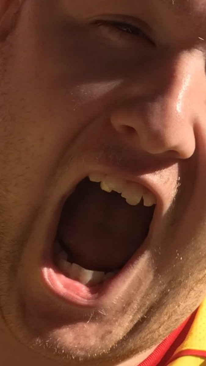 Robson O'Reardon🎗 tweet media