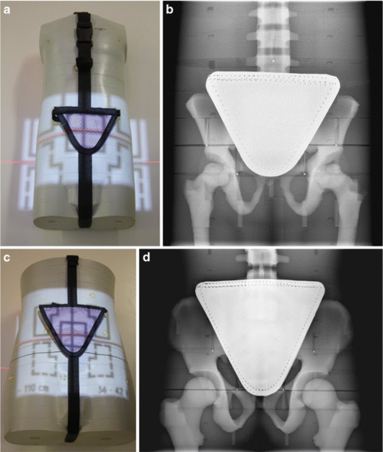Feb eToc:
Do we need #gad for #brain #MRI in #kids? Maybe not....
Female gonadal shields - more harm than good?
Voiding urosonography for #reflux
And MORE!
ow.ly/Opxb30ioFRg
#PedsRad <a href="/The_ASPNR/">American Society of Pediatric Neuroradiology</a>