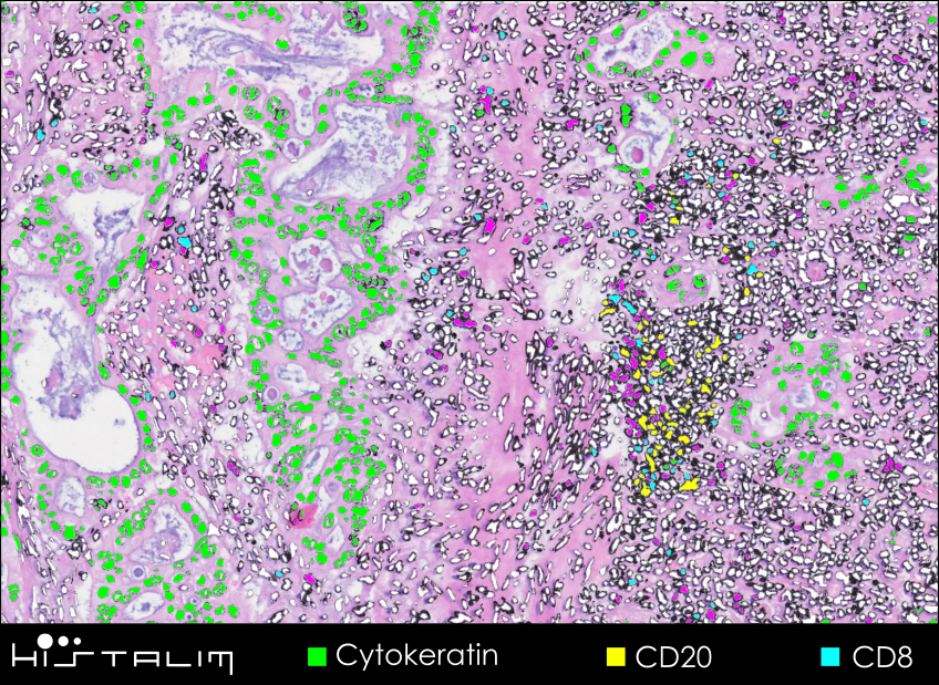 HISTALIM tweet media