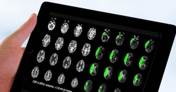 LetsFaceItCare's tweet photo. "#ArtificialIntelligenceTool Could Speed #StrokeDetection"
https://t.co/uLV3h1f8nb
#LatestHealthCareNews https://t.co/kiKaTKvZl0
