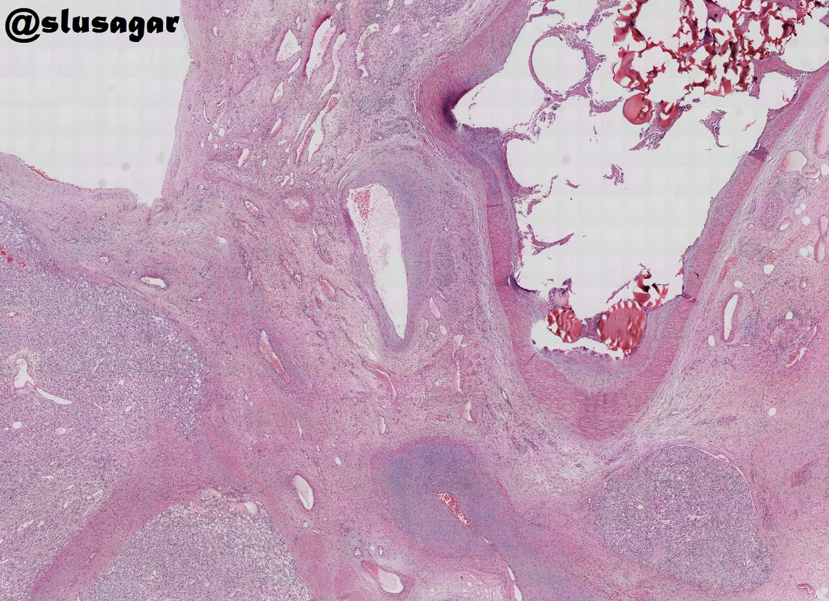 slusagar's tweet photo. I normally don't play the #Pathstories game, but couldn't pass up on this #GUpath #LPpath radical nephrectomy specimen:
can you build a story and Dx? https://t.co/QZEILT6ai1