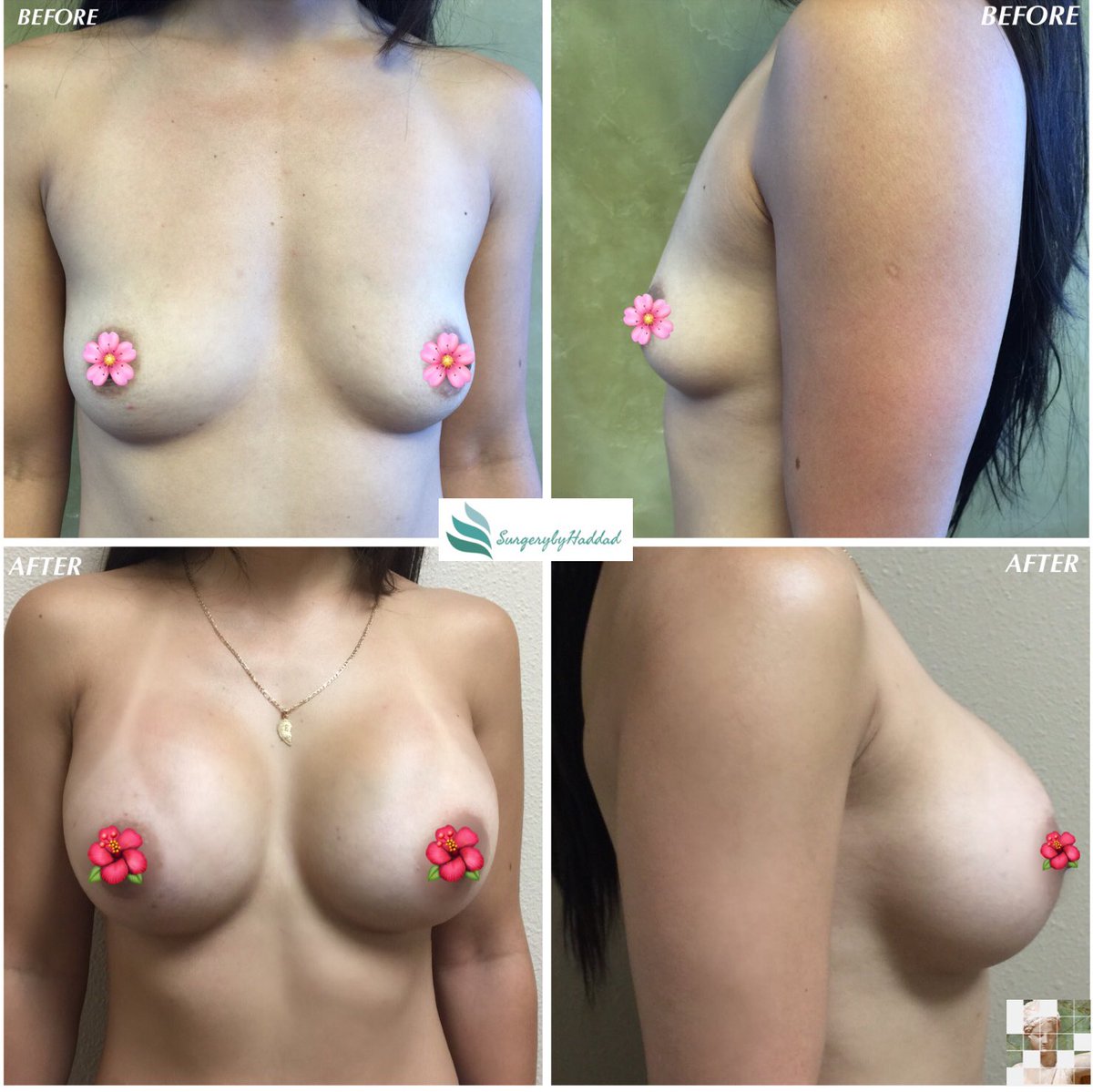 Nazih M. Haddad M.D. tweet media