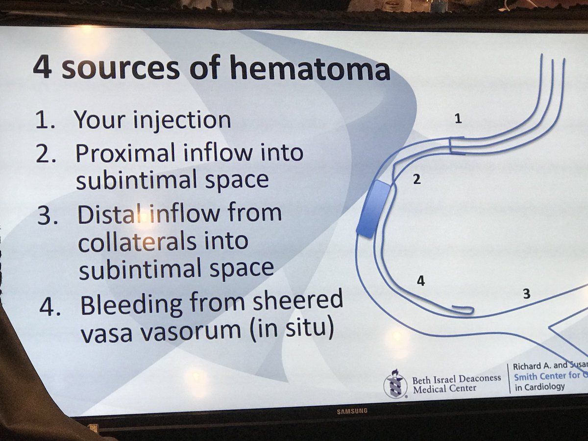 4 sources of hematoma by Bobby Yeh at CTO Summit 2018 - understanding cause helps guide Rx. @cto2018, @cto101 @MLCTOcourse