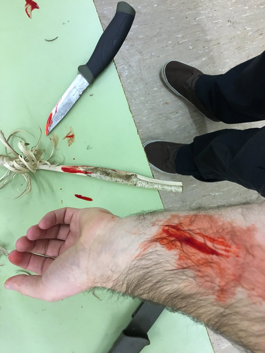 LR0B5's tweet photo. Expert first aid care at @GowertonScout tonight - even stitched me up! #firstaidbadge https://t.co/QYXf52o9CN