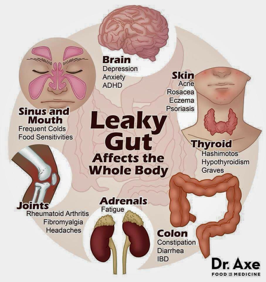 MikeGoldade's tweet photo. This is why so many people have incredible health improvements with our Probio5 and Bio Cleanse!! I had no idea leaky gut was linked to SO many health issues!!! https://t.co/IKvDqH1XqE