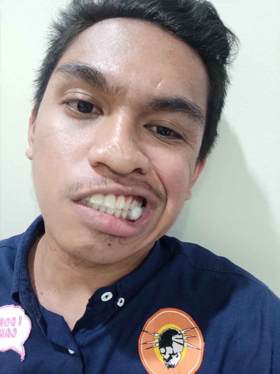 warrendibb's tweet image. Cleaning and tooth extraction earlier 😊 #roadtoB