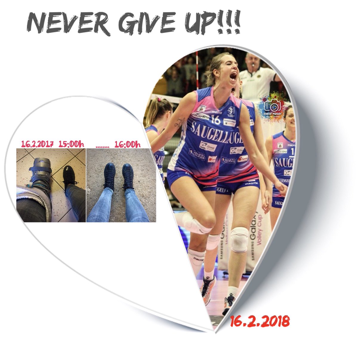 It’s been 1year since they took off my Achilles tendon brace and every day since then,I’ve started my rehab hoping to return to play volleyball at a high level again.Tomorrow Final4 of Italian cup is expecting us and I’m more than grateful for it.Thanks everyone who has helped me