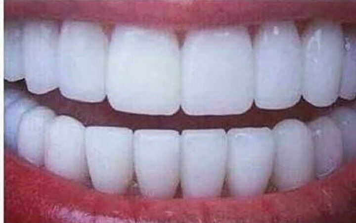 MarkettaJulsrud's tweet photo. If I had this set of teeth I wouldn't even bother talking, I'd just smile till I die https://t.co/RL9QJyFLCr