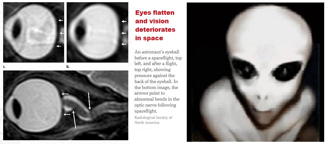 BlloydbLloyd's tweet photo. #nephilim #Aliens #UFO #tallwhites #nordicwhites #fallen are fallen deformed nocturnal beings. They are #demons.  DO NOT FOLLOW THEM. https://t.co/lGp4TQj6nj