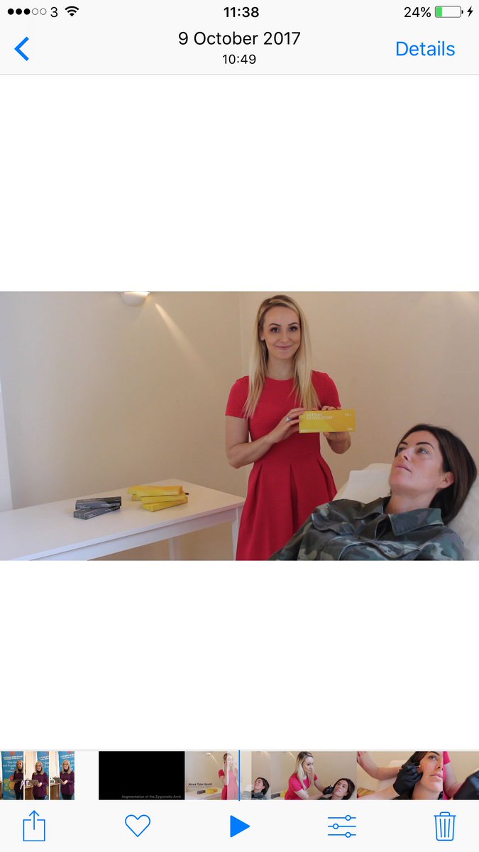 A pretty darn good cheek filler demo by Alexa at buff.ly/2F4hVzy / Head to our IG @dermalrevolution to watch! #cheeks #aesthetics #dermalfillers #fillers #cheekfiller