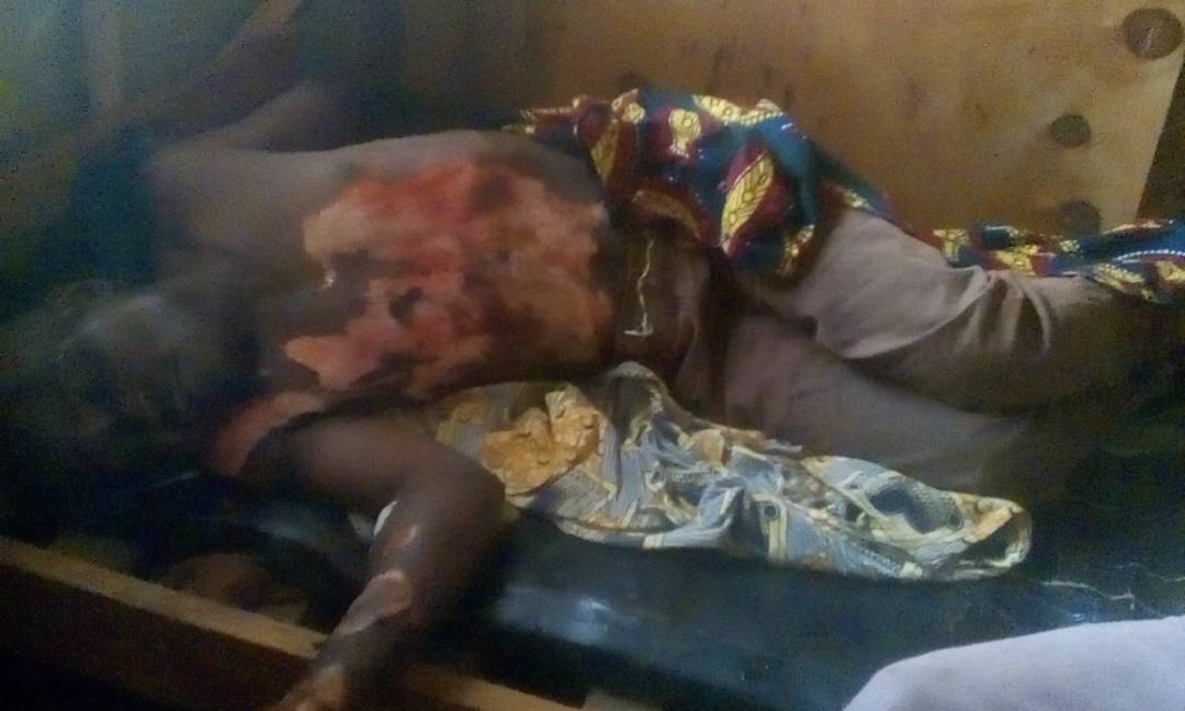 MeBalikwisha's tweet photo. C'est vraiment révoltant ce N ième forfait que vient de nous faire subir nous population de Isale BULAMBO en chefferie de Bashu territoire de Béni province du Nord-Kivu. Ces images sont de l'assassinat d'hier soir 16/02/. Silence total des autorités, nous n'y comprenons plus rien https://t.co/3qMtchNgcz