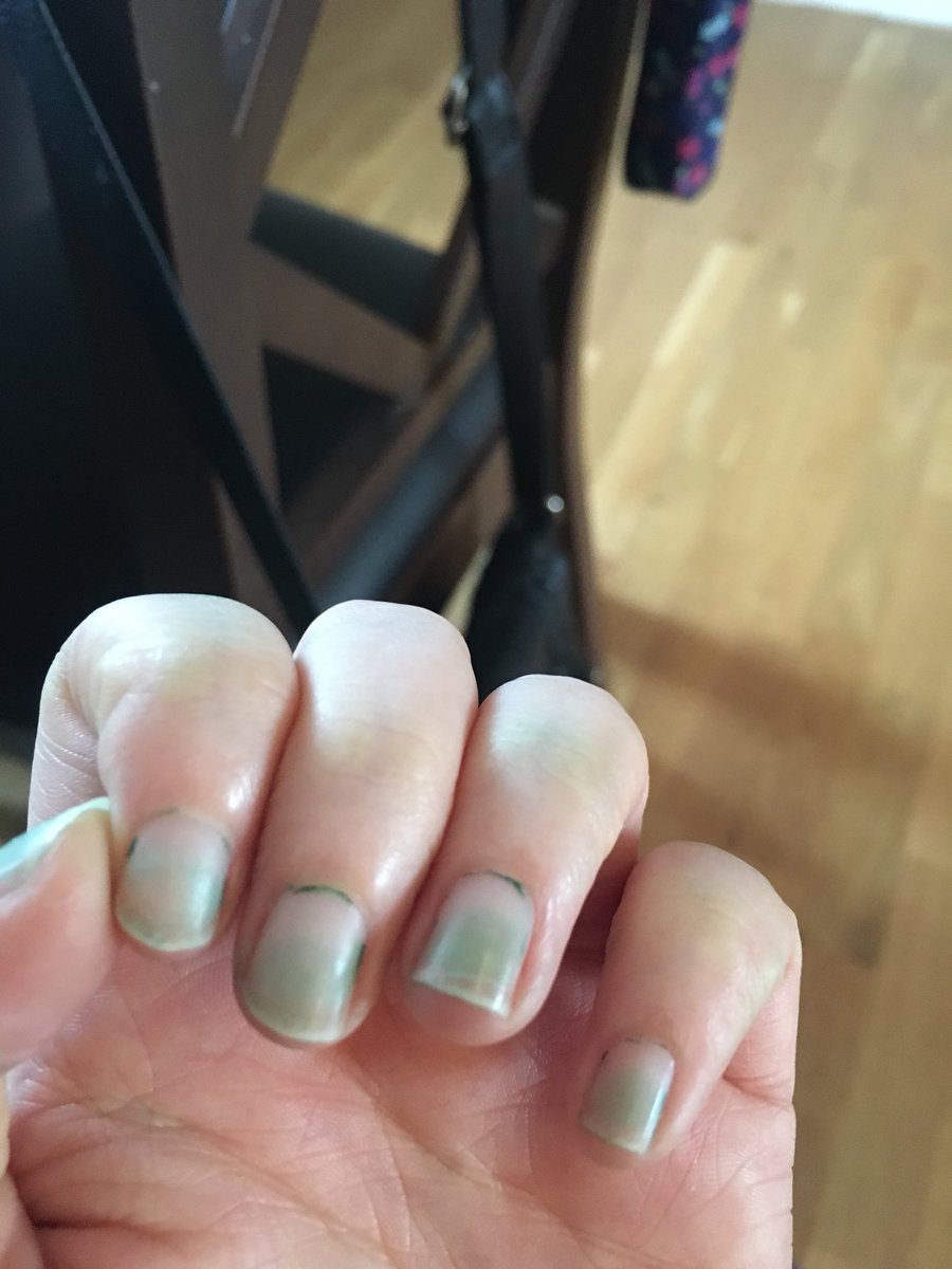 LeahHarrison93's tweet photo. @ciatelondon I’ve been scrubbing all morning trying to get this nail varnish off I received from my @GlossyboxUK and my nails are dyed a horrible green !! 🙈😞 https://t.co/uh3TyQPot0