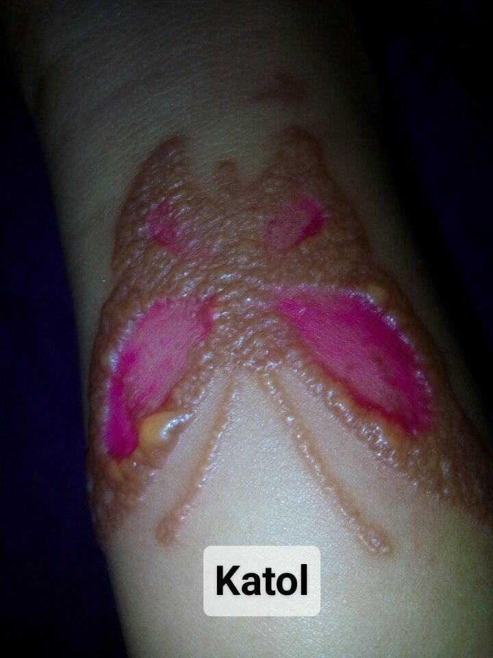 KapusoMoJessicaSoho on Twitter "Butterfly Henna Tattoo gone wrong? 😱 