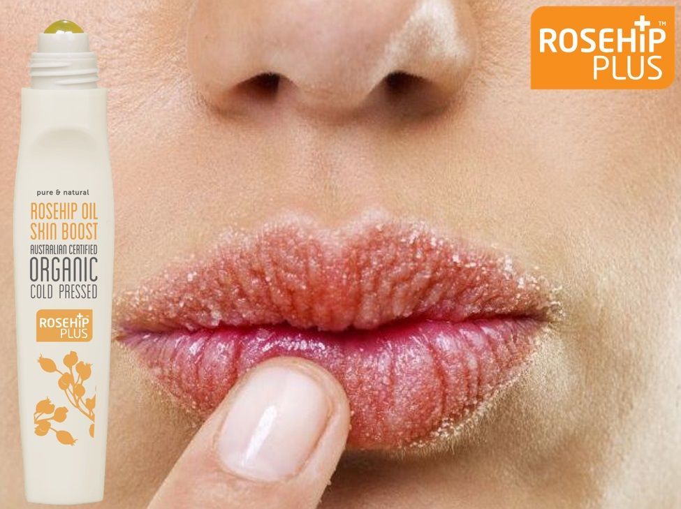RosehipPLUS_UK's tweet photo. Roll On Rosehip Oil is perfect for your handbag to apply on concerned areas, lips and cuticles https://t.co/lz55wf0iC7